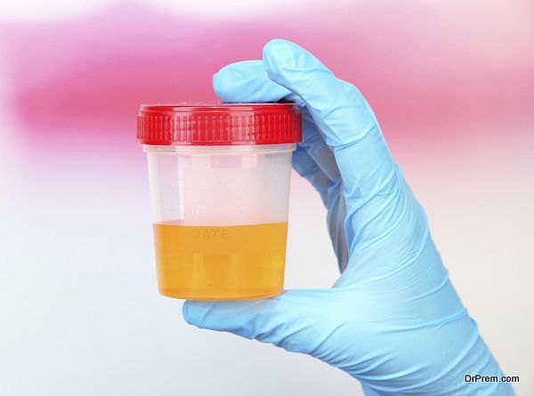 Medical urine test, close-up